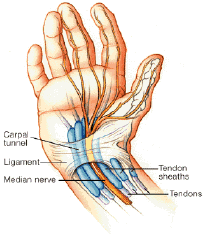 Los Angeles, West Hollywood, Beverly Hills Chiropractic Carpal Tunnel Pain Relief