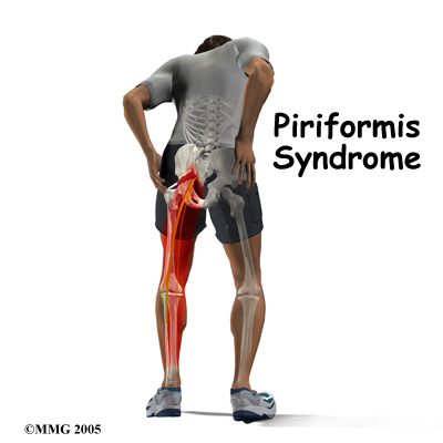 Piriformis