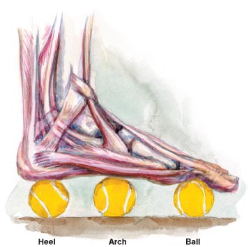 Plantar fasciitis treatment--chiropractic