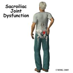 sacroiliac joint dysfunction, west hollywood chiropractor